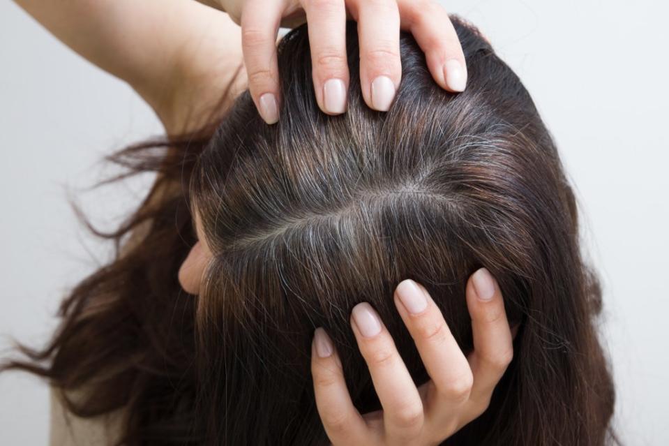 The exact cause of premature graying is still unclear. Getty Images