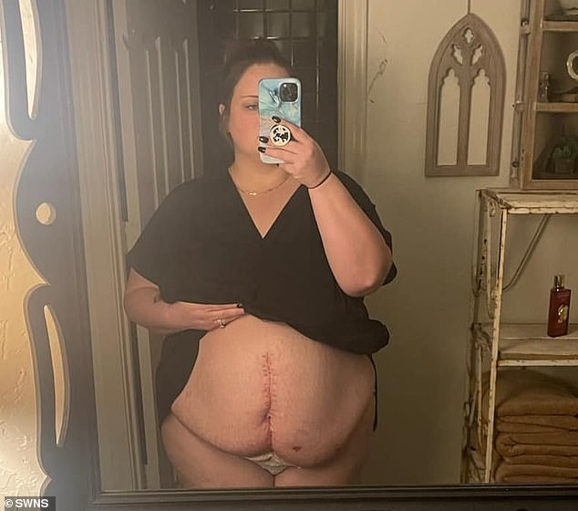 The mom-of-one, from Dallas, had been rushed for an emergency C-section after her baby became stuck in the breach position