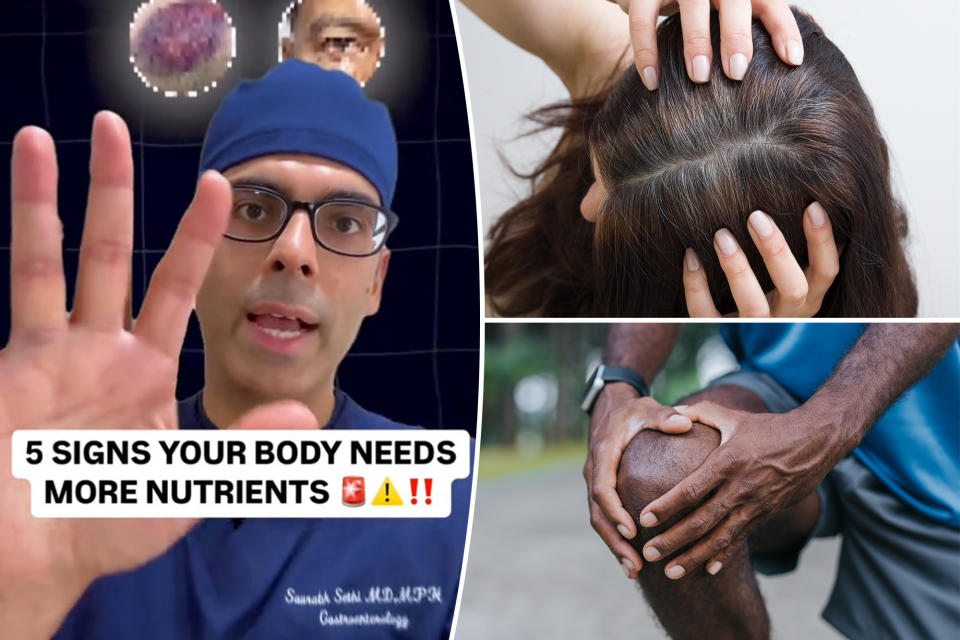 California gastroenterologist Saurabh Sethi is sharing five signs that your body needs more nutrition — brittle nails, eyelid twitching, clicking of the joints, premature greying of the hair and bruising easily.