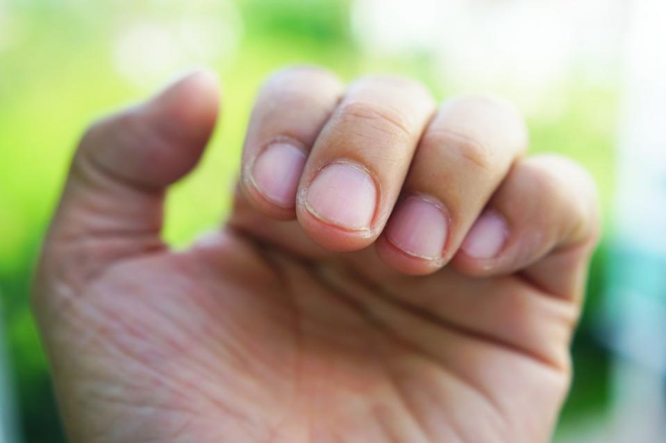 Nails are primarily composed of the protein keratin, so it’s crucial to eat plenty of protein to keep nails healthy and strong. Getty Images/iStockphoto