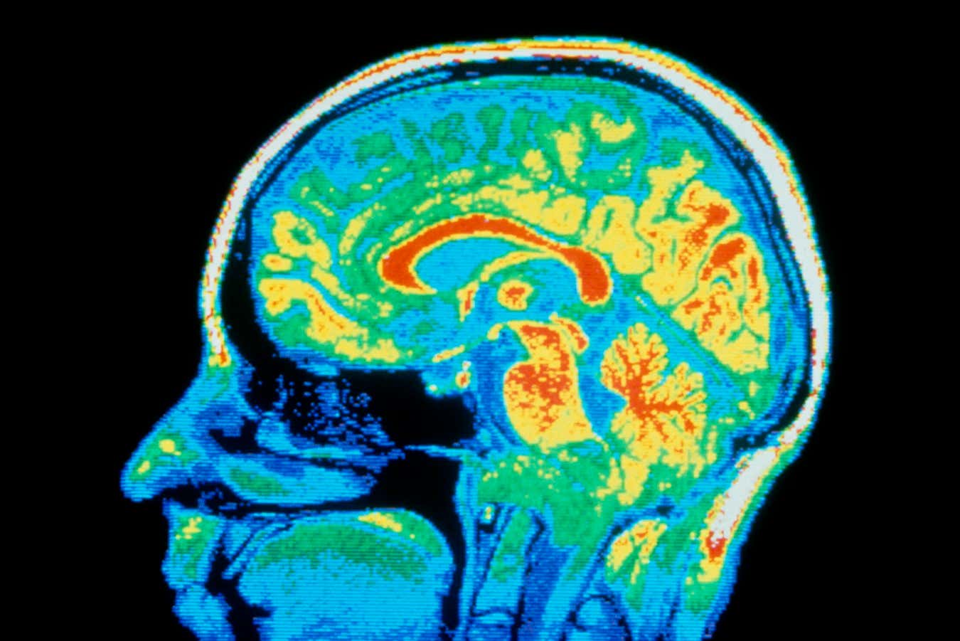 False-colour nuclear magnetic resonance (NMR) image of a human head