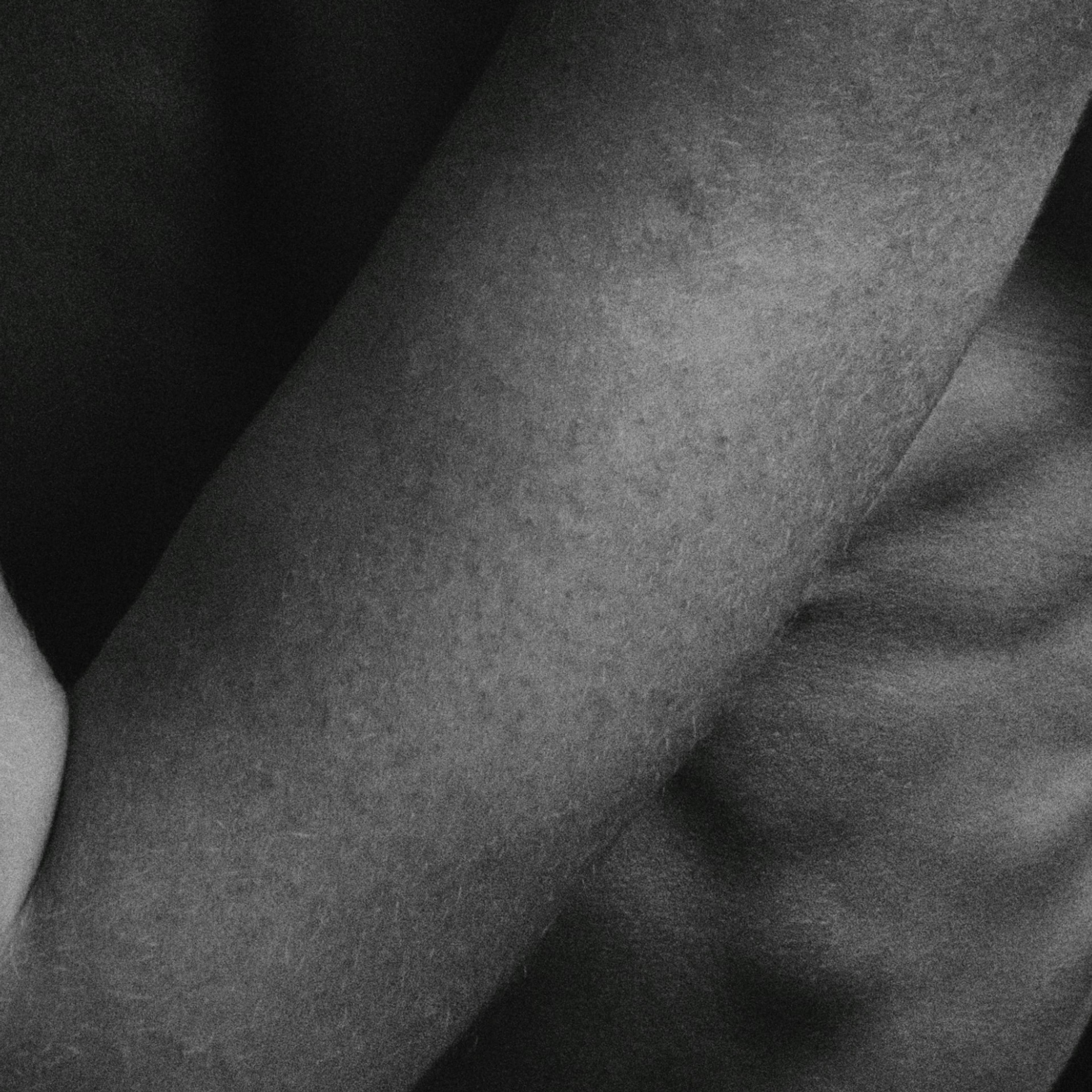 Black and white close-up photo of a person’s arm showing skin texture and pigment and shadows; protruding ribs are visible behind the arm.